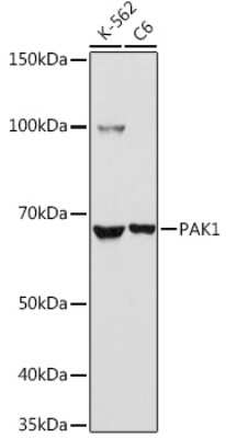 Western Blot: PAK1 AntibodyAzide and BSA Free [NBP2-95107]